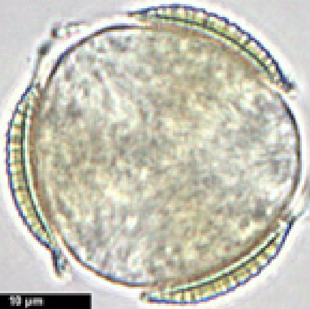 Brassica napus (pollen; polaire aanzicht; focus op doorsnede).