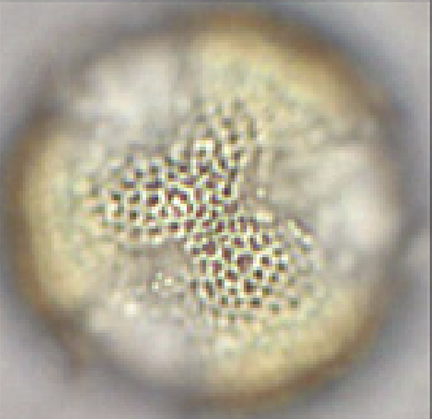 Brassica napus (pollen; polair aanzicht; focus op oppervlak).