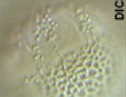 Brassica napus (pollen; sculptuur).