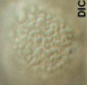 Calluna vulgaris (sculptuur).