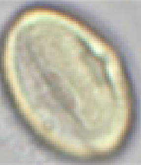 Castanea sativa, equatoriaal aanzicht, doorsnede