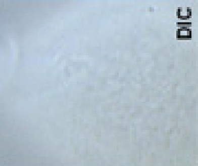 Robinia_pseudoacacia