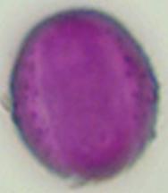 Aesculus_hippocastanum