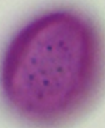 Aesculus_hippocastanum