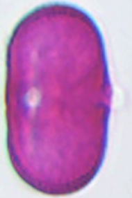 Anthriscus_sylvestris