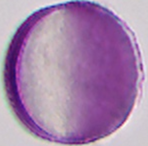 Brassica napus (pollen; equatoriaal aanzicht; focus op doorsnede).