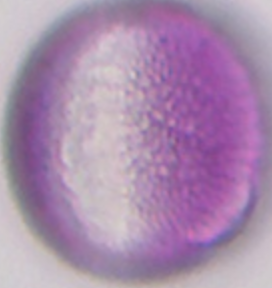 Brassica napus (pollen; equatoriaal aanzicht; focus op oppervlak).