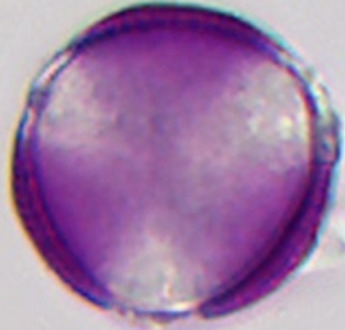 Brassica napus (pollen; polaire aanzicht; focus op doorsnede).