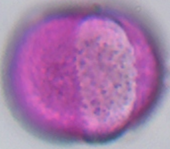 Papaver_somnoliferum