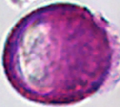 Salix_alba_var_tristis