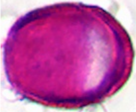 Saxifraga_rotundifolia