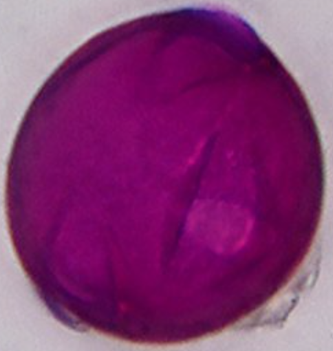 Symphoricarpos_albus