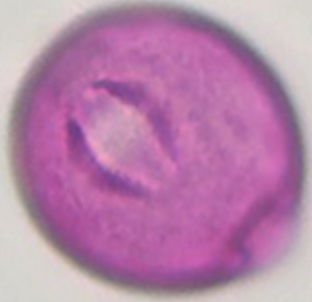 Symphoricarpos_albus