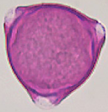 Symphoricarpos_albus