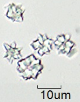 calciumoxalaat kristallen