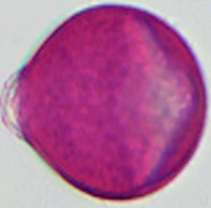 Trifolium-repens (21-25 µm)