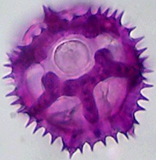 Grijswaarde maatreferentie: Cichorium intybus 40 µm.